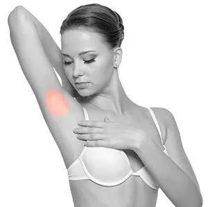 3 x Underarms Laser Hair Removal(New Client Only) Underarms Highlighted