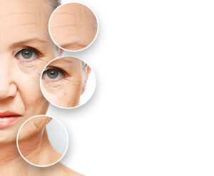 anti-aging procedures