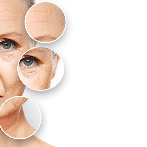 anti-aging procedures
