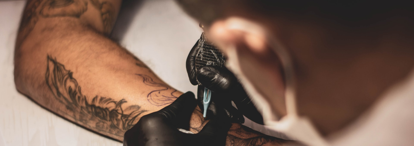 Best Laser Tattoo Removal NY