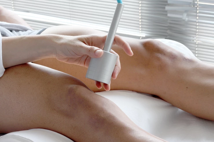 Laser Hair Removal and Cancer