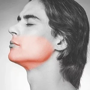 Men or Women's Lower Face, Front of Neck, and Cheeks Laser Hair Removal