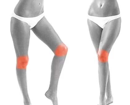Women Lower Legs and Knees Laser Hair Removal in NYC