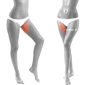 Women’s Full Bikini and Inner Thigh Laser Hair Removal For Women In NYC
