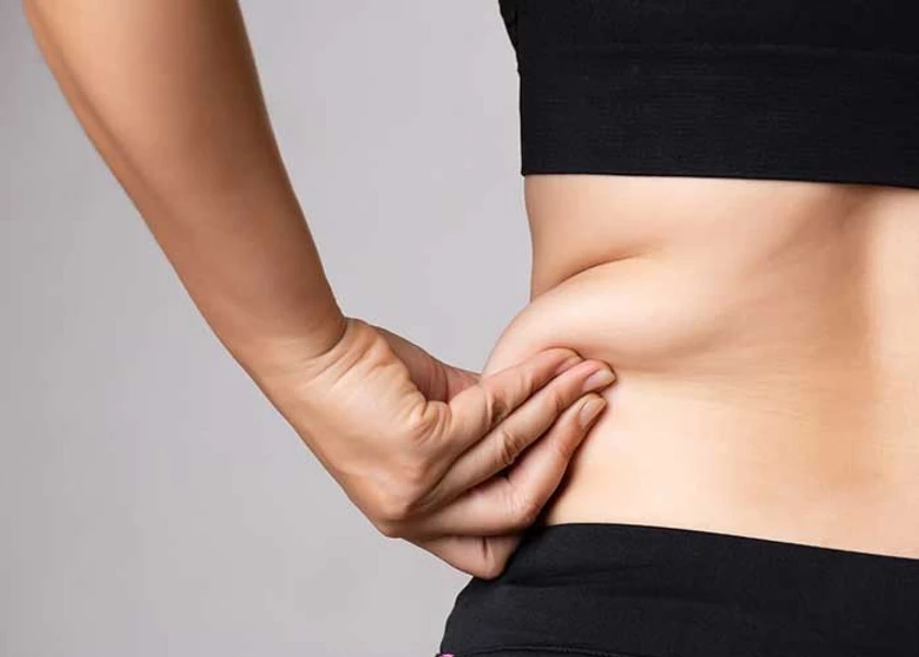 Will Coolsculpting Help You Eliminate Belly Fat?