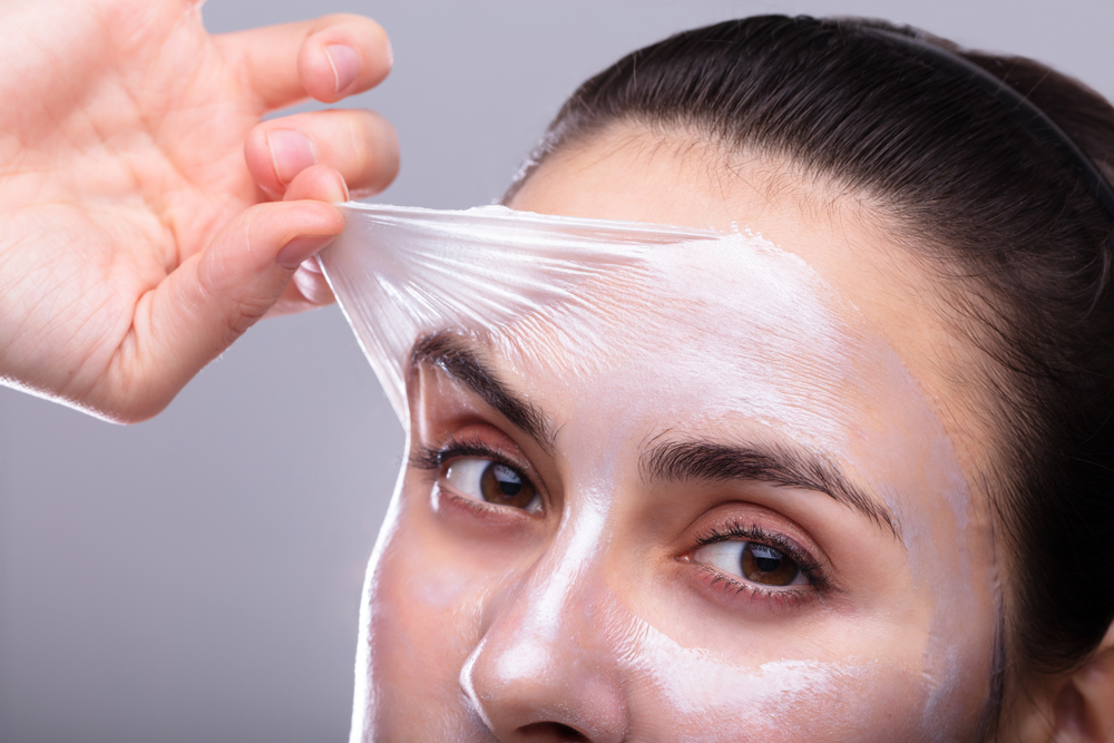 removing chemical peels