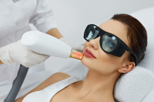 laser treatment on face