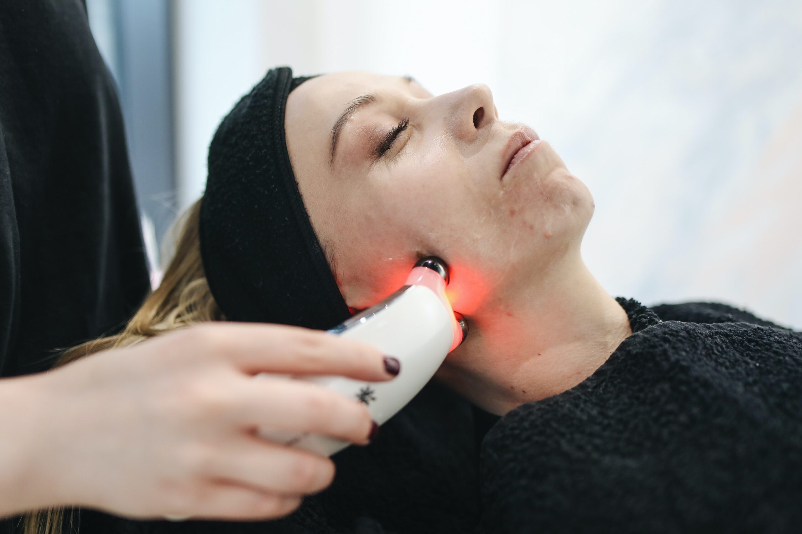 Which Skin Laser Treatment Is Best for Acne Scars?