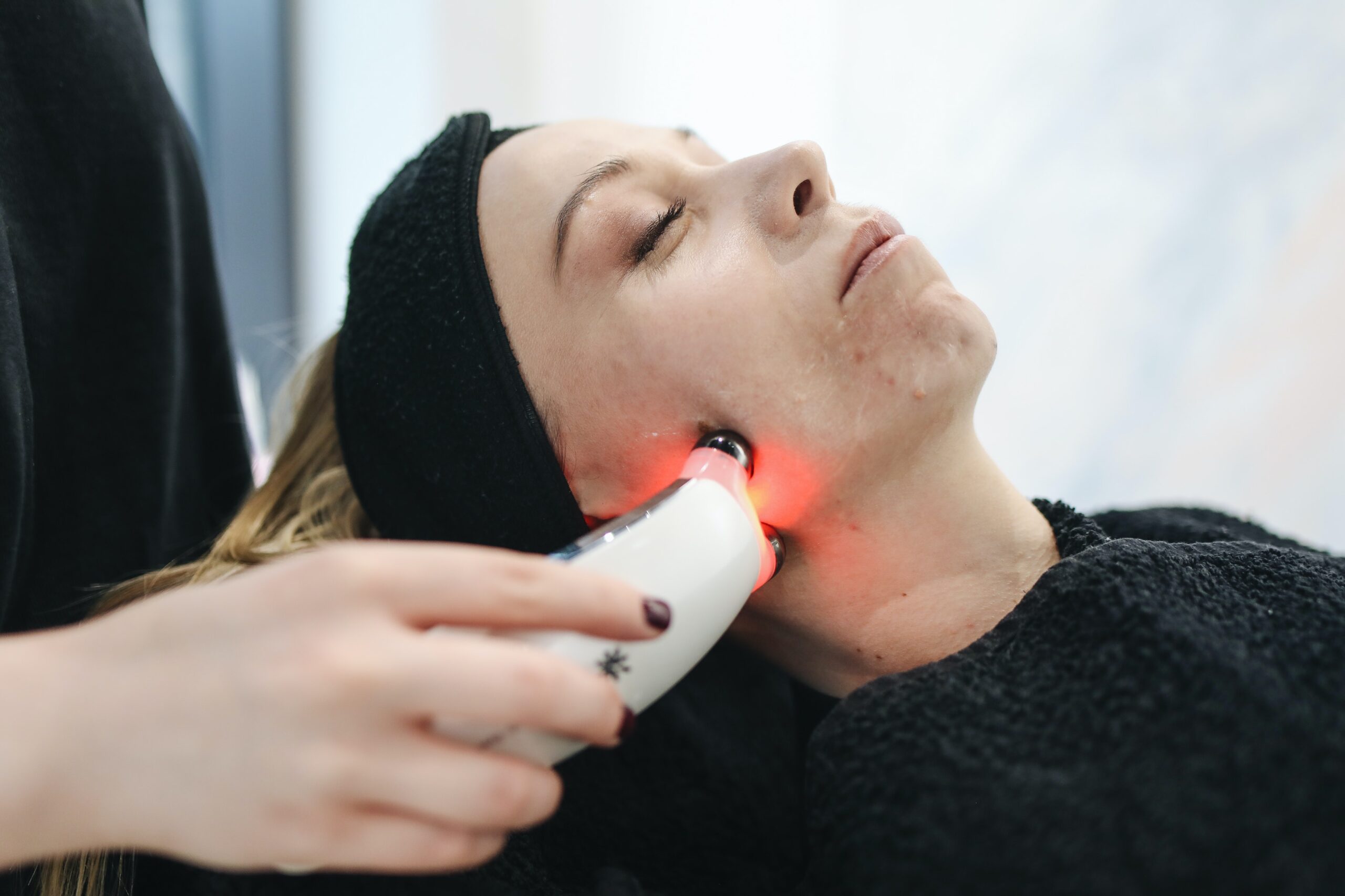 best facial laser treatments