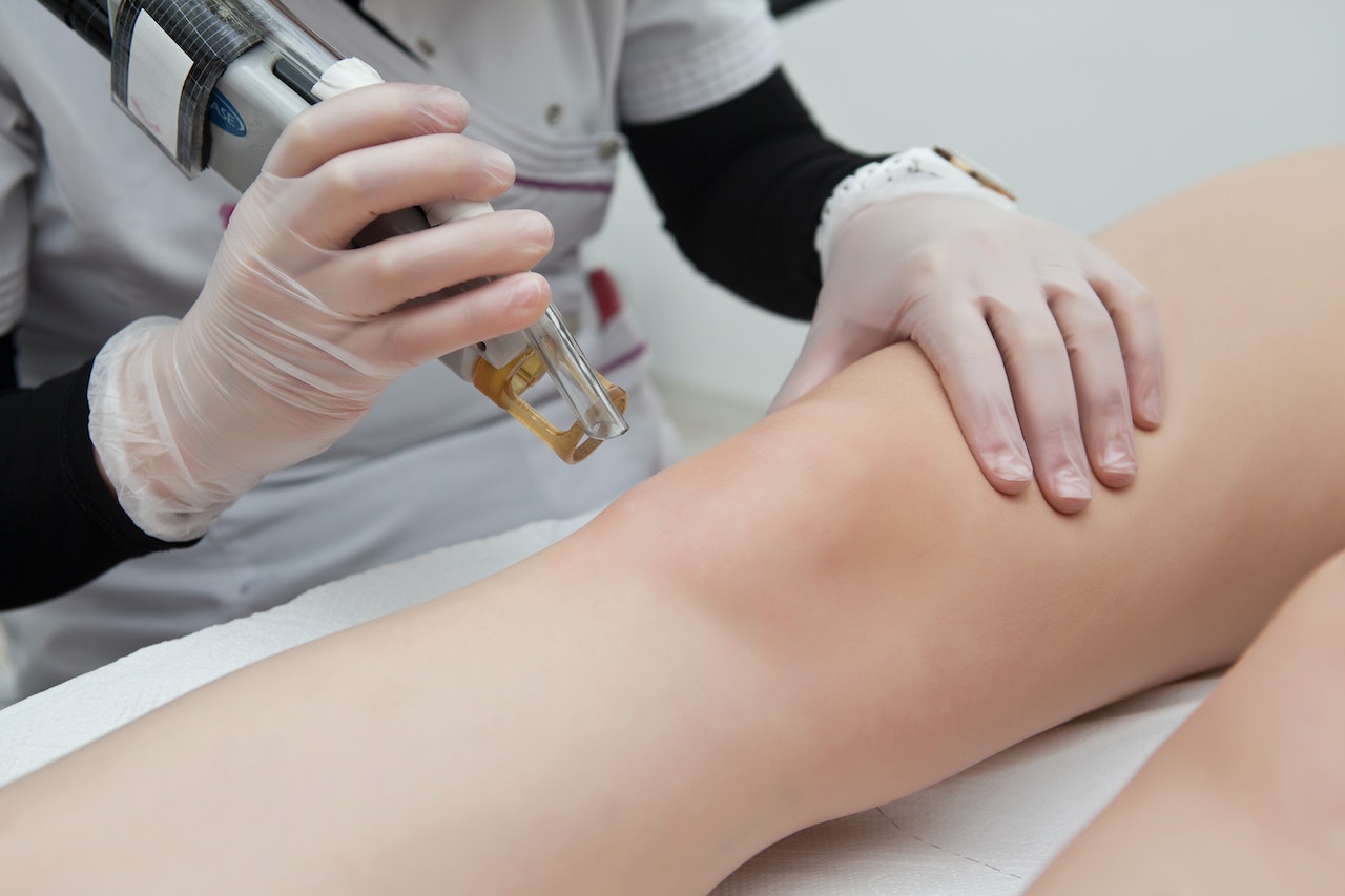 Reasons to Switch From Waxing to Laser Hair Removal