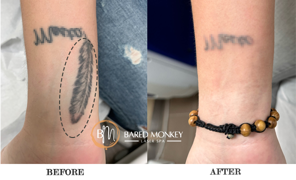 before and after-TATTOO3