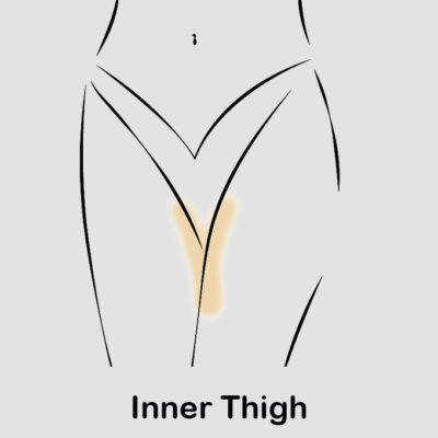 coolsculpting inner thigh updated