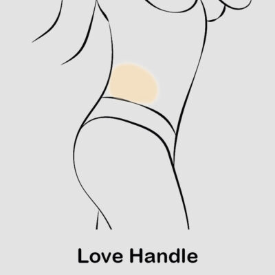 coolsculpting love handle updated