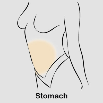 coolsculpting stomach updated